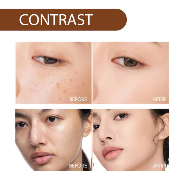 Hoygi Niacinamide Serum for Brightening and Hydration