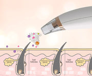 Powerful Electric Blackhead Remover for Home Use