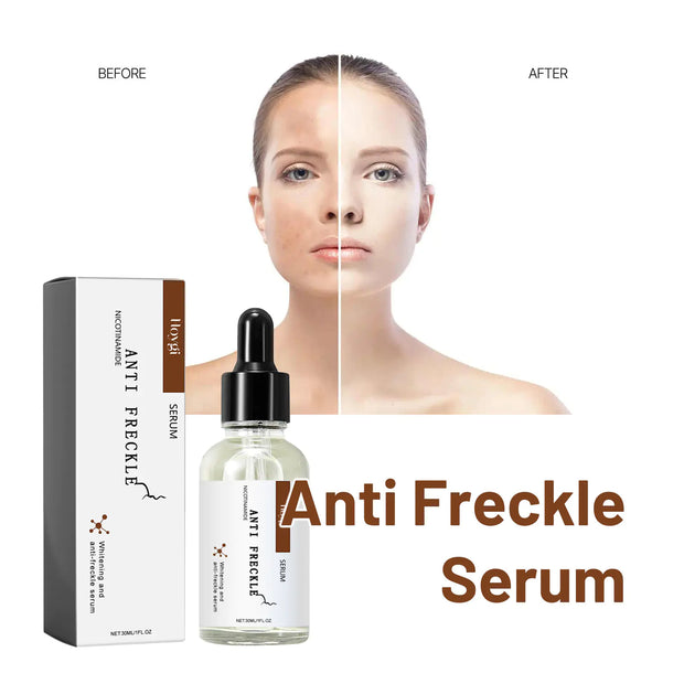 Hoygi Niacinamide Serum for Brightening and Hydration